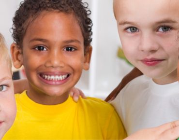 Frenectomy and Gingivectomy